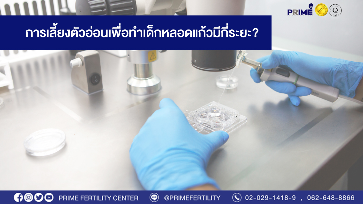 การเลี้ยงตัวอ่อนเพื่อทำเด็กหลอดแก้วมีกี่ระยะ