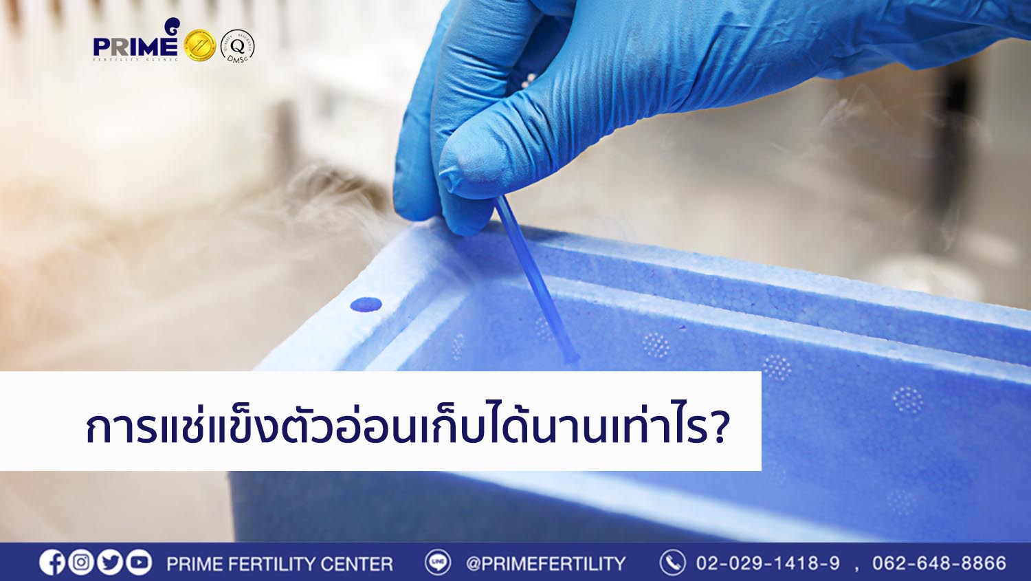 การแช่แข็งตัวอ่อนสามารถเก็บได้นานเท่าไร prime