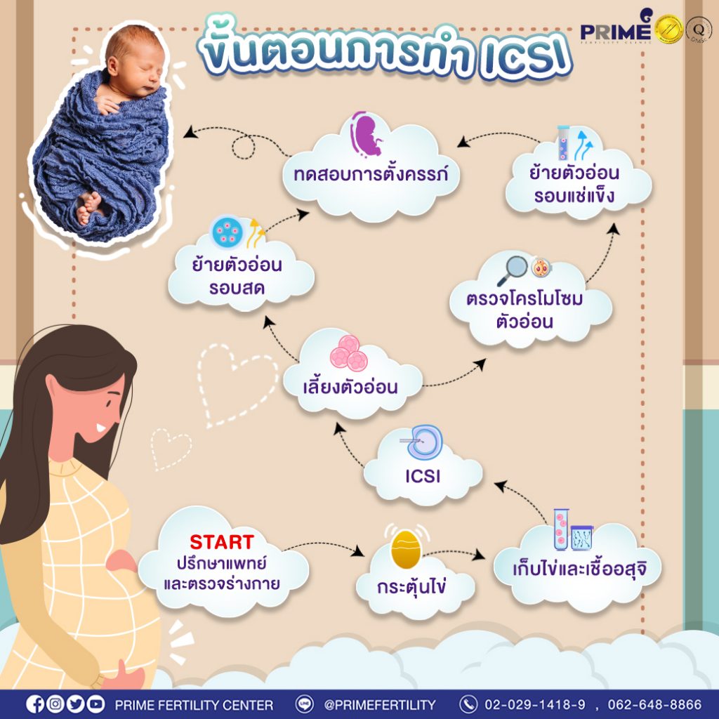 เส้นทางสู่ icsi
