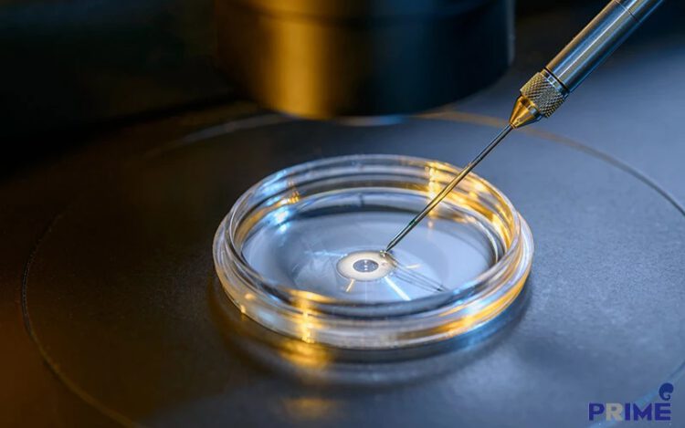 IVF, เด็กหลอดแก้ว,​试管婴儿