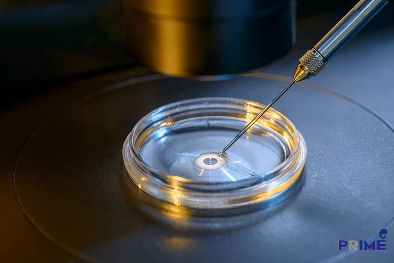 IVF, เด็กหลอดแก้ว,​试管婴儿