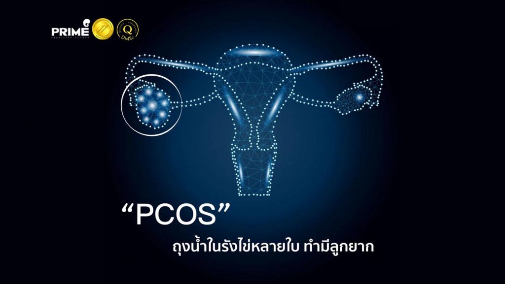 pcos1