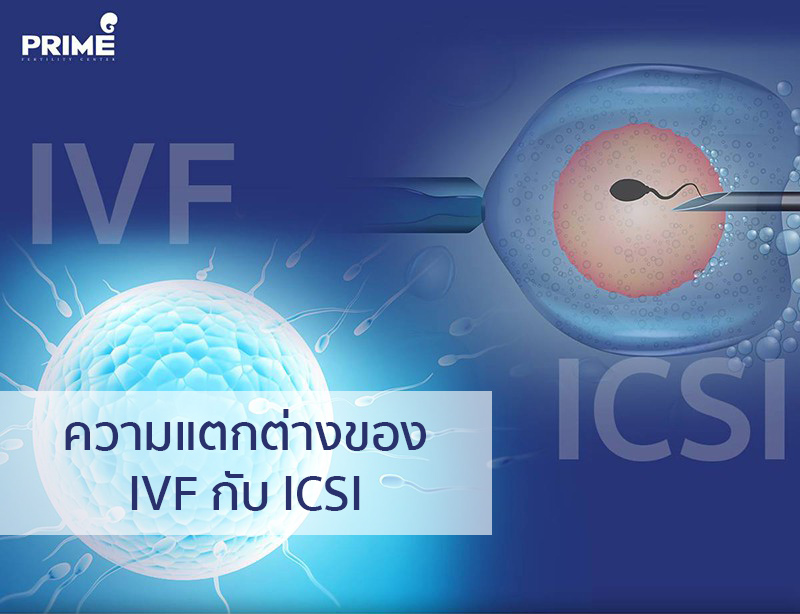 IVF,ICSI,试管婴儿,单精子注射