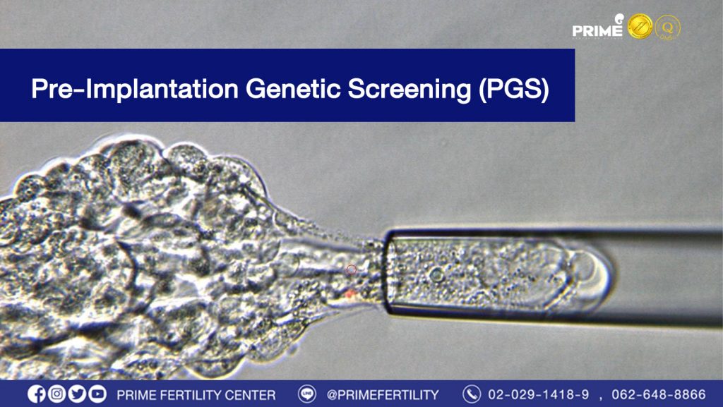 Pre Implantation Genetic Screening PGS