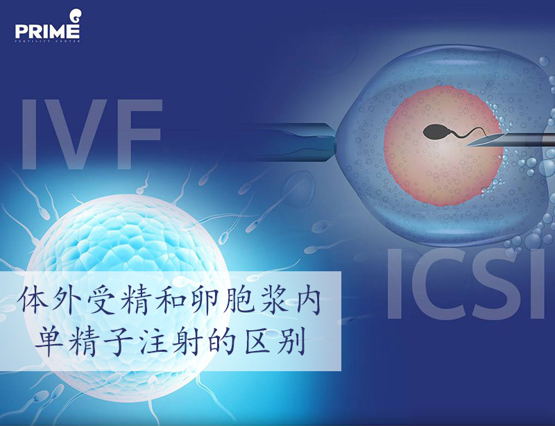 IVF,ICSI,试管婴儿,单精子注射