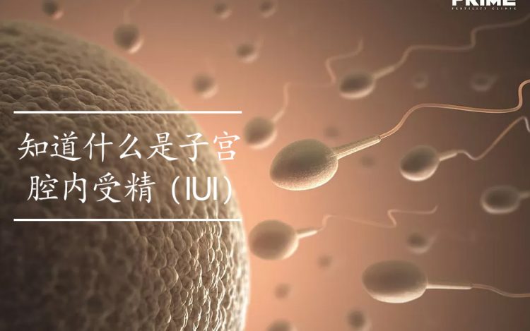 IUI,胞浆内单精子注射,ฉีดเชื้อผสมเทียม