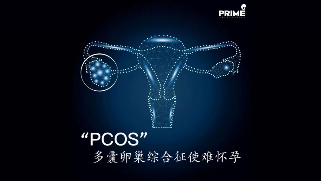 pcocn