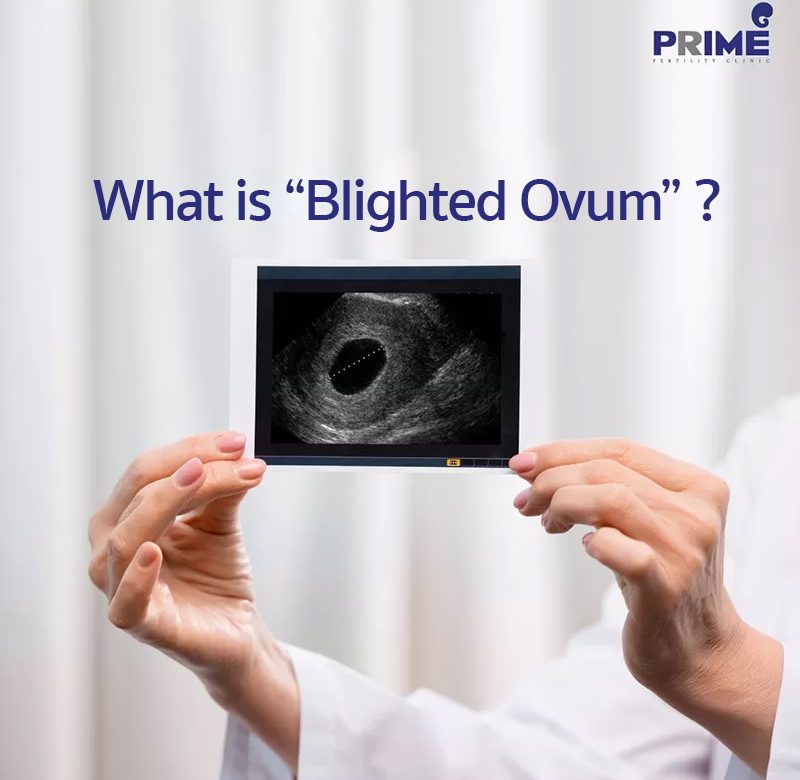Blighted Ovum, ท้องลม, 假妊娠
