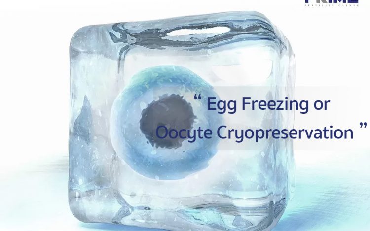 冷冻卵子, Egg Freezing,ไข่แช่แข็ง