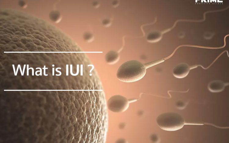 IUI,胞浆内单精子注射,ฉีดเชื้อผสมเทียม