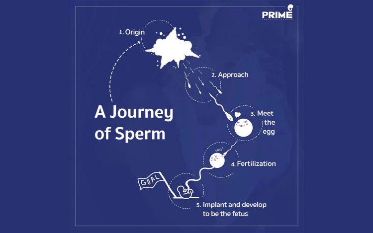 Sperm,ICSI,เส้นทางอิ๊กซี่,精子