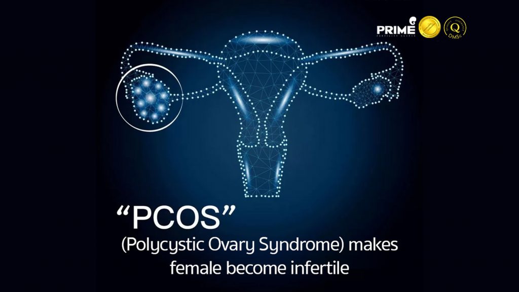 pcoseng