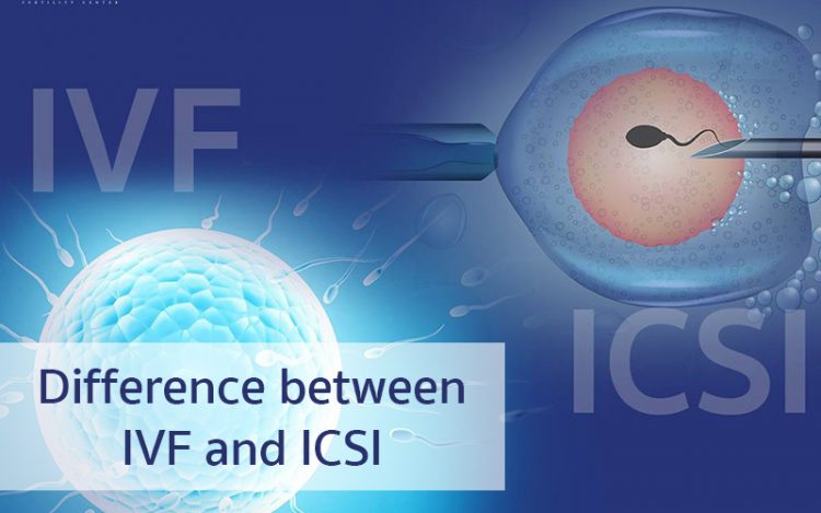 IVF,ICSI,试管婴儿,单精子注射