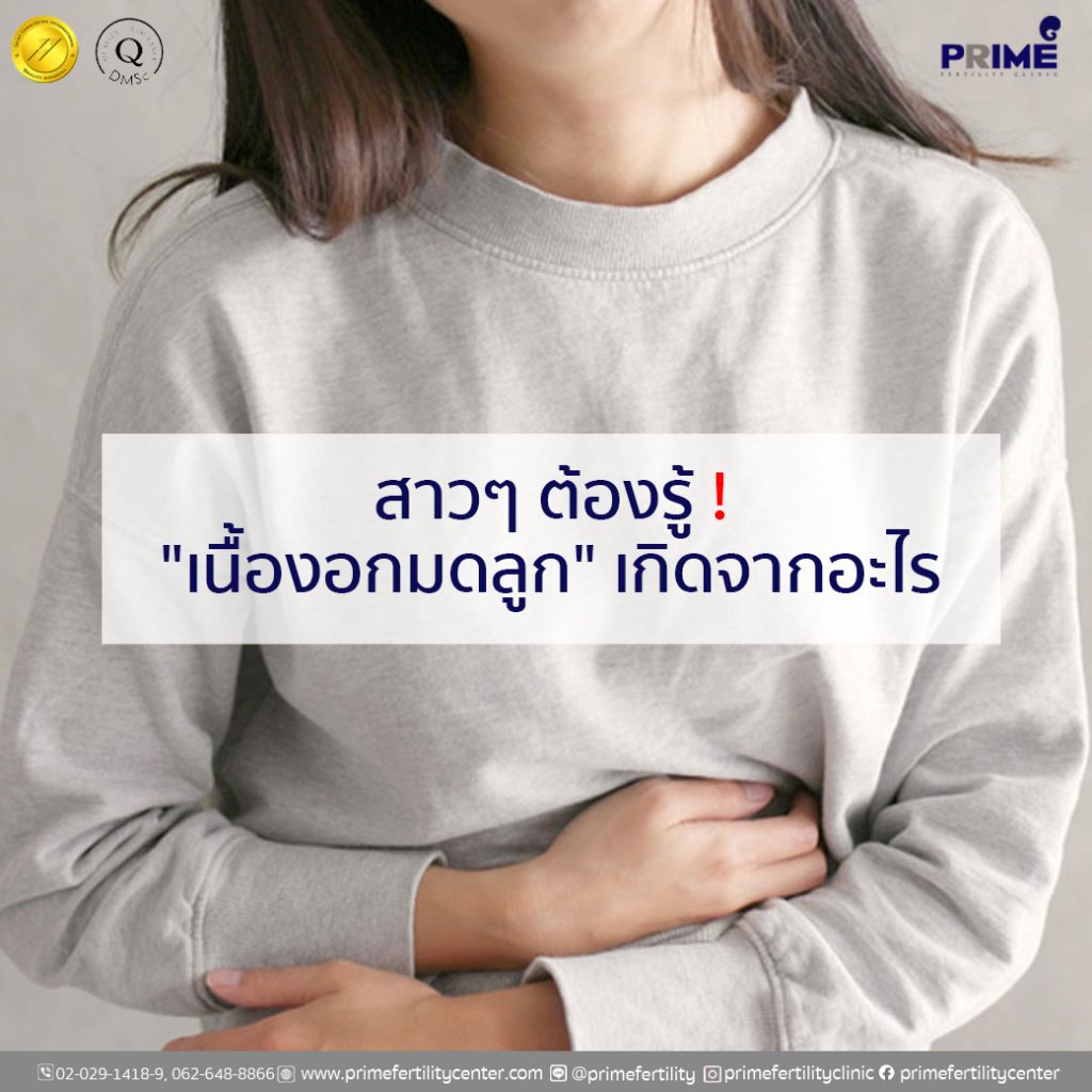 เนื้องอกig