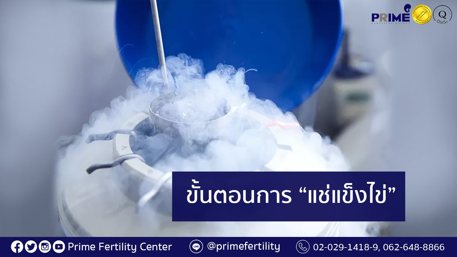 การฝากไข่แช่แข็ง