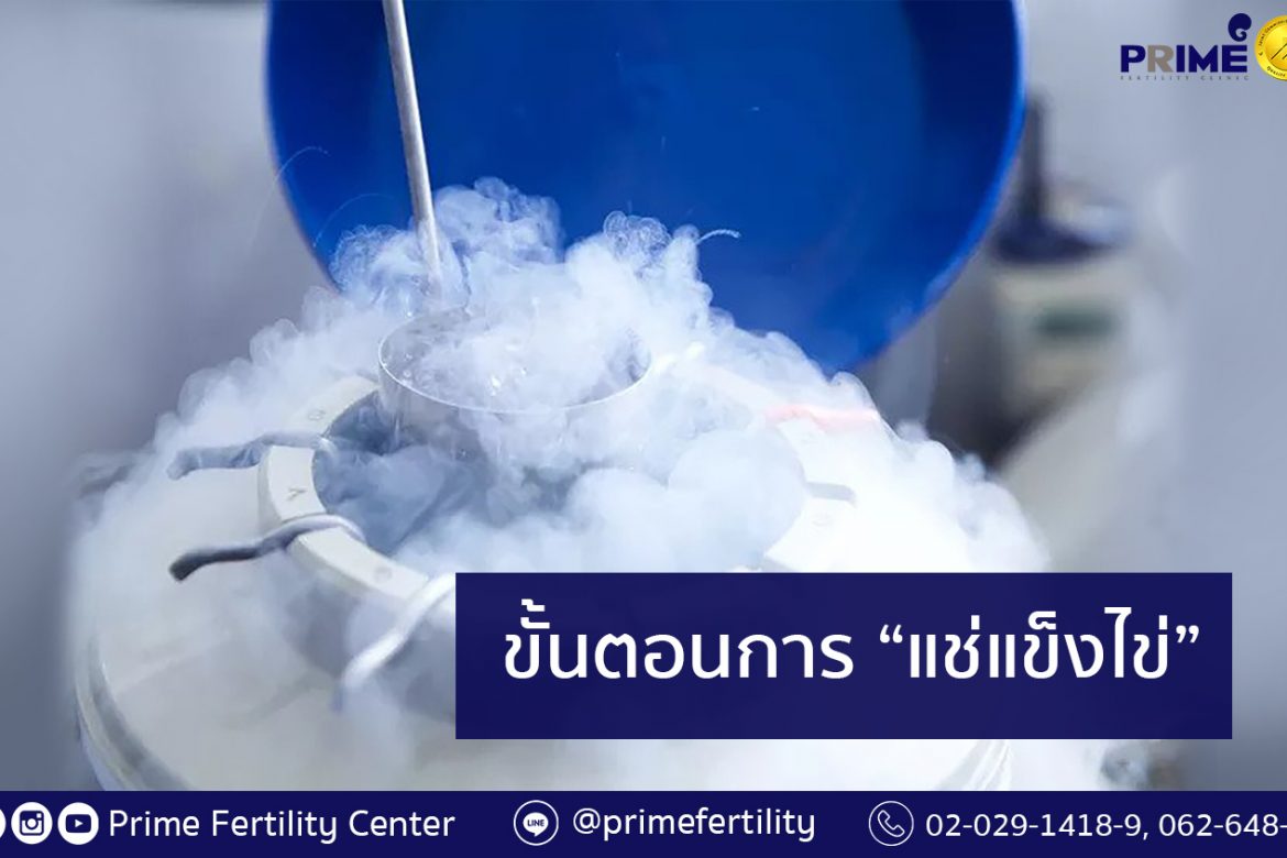 Egg Freezing,การฝากไข่แช่แข็ง,冷冻卵子