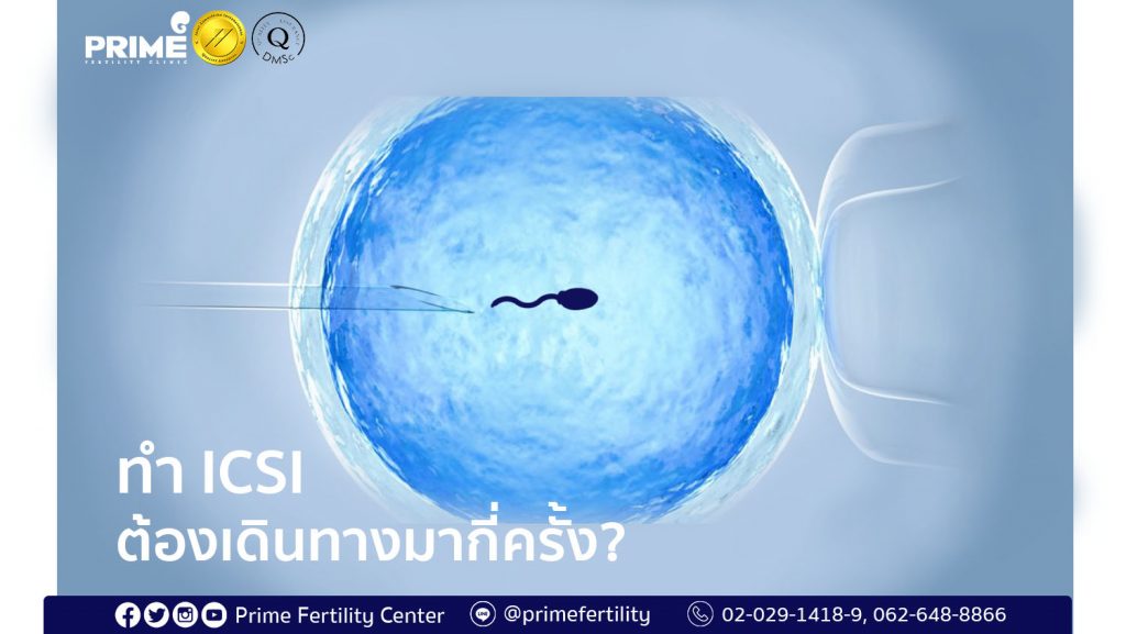 How often do you need to visit the clinic during your ICSI treatment, ทำ ICSI ต้องเดินทางมากี่ครั้ง,做试管婴儿（ICSI）要过来诊所几趟