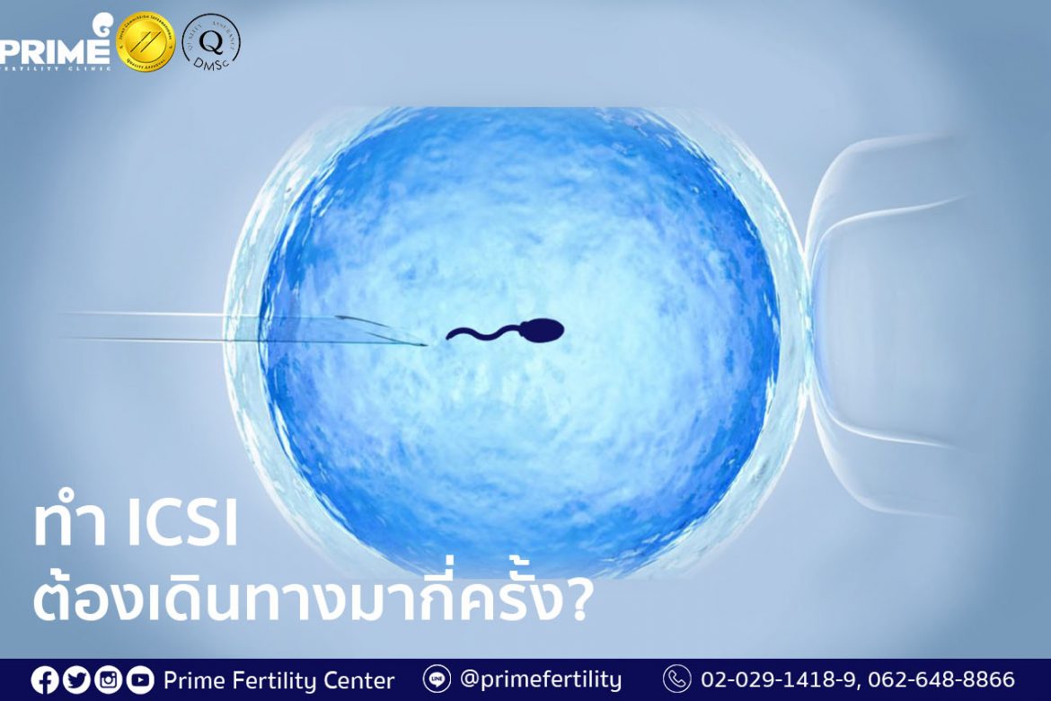 How often do you need to visit the clinic during your ICSI treatment, ทำ ICSI ต้องเดินทางมากี่ครั้ง,做试管婴儿（ICSI）要过来诊所几趟