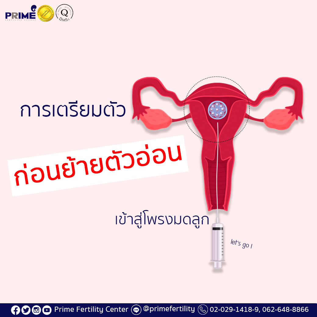 การเตรียมตัวก่อนการย้ายตัวอ่อนเข้าสู่โพรงมดลูก1