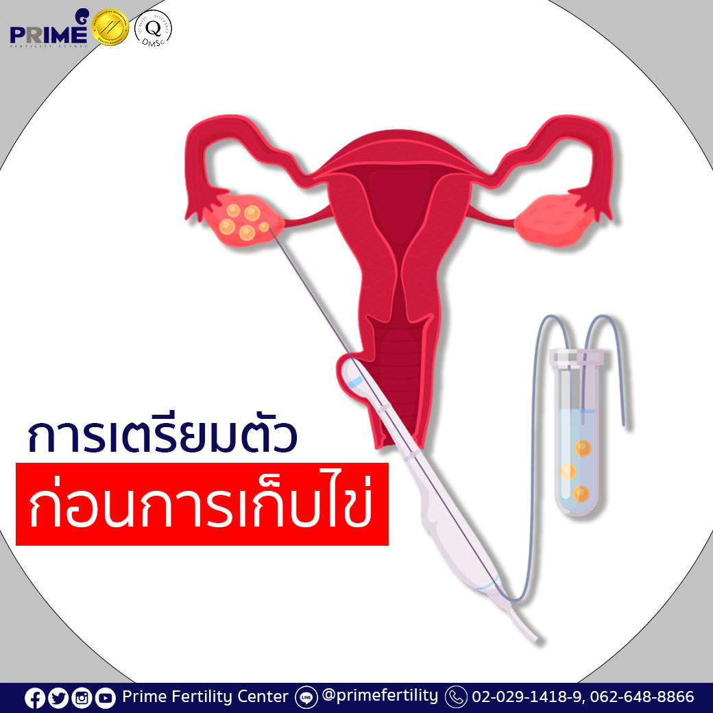 การเตรียมตัวก่อนการเก็บไข่1