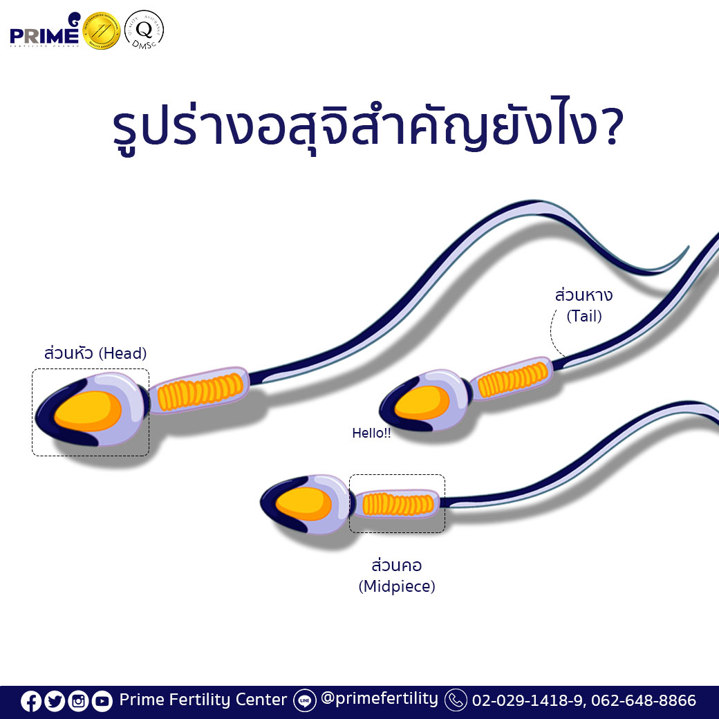 รูปร่างสเปิร์มสำคัญยังไง