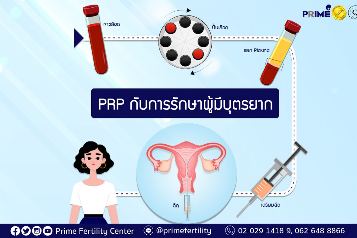 PRP Treatment and Infertility,PRP กับเรื่องมีบุตรยาก,高浓度血小板血浆 (PRP) 与不孕不育症