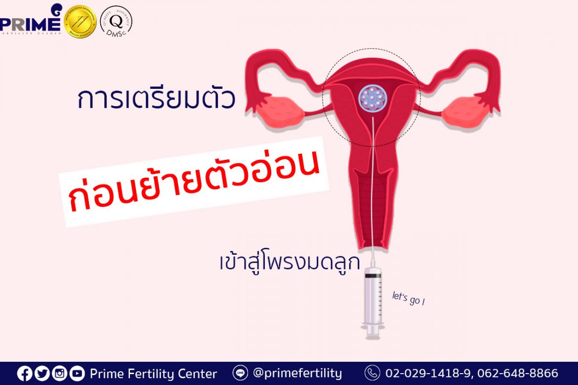 Preparation for Embryo Transfer,การเตรียมตัวก่อนย้ายตัวอ่อนเข้าสู่โพรงมดลูก,移植胚胎前的准备