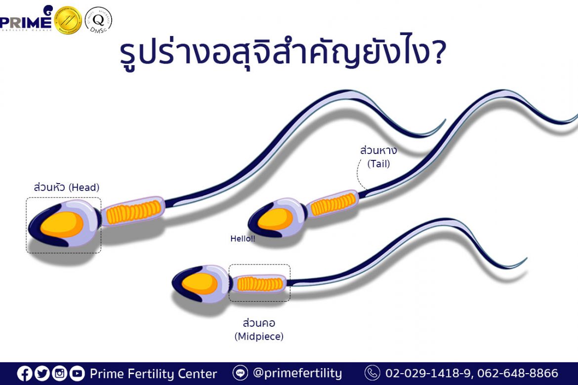 How is sperm morphology important,รูปร่างอสุจิสำคัญยังไง,精子形态重要性