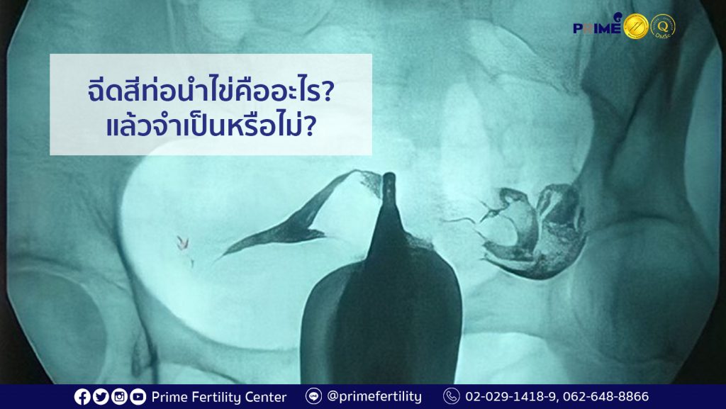 ฉีดสีท่อนำไข่ web