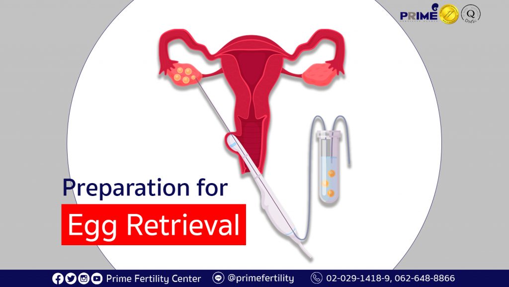Preparation for Egg Retrieval, การเตรียมตัวก่อนการเก็บไข่, 取卵之前的准备