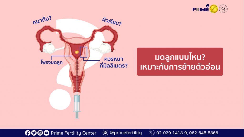 มดลูกแบบไหน