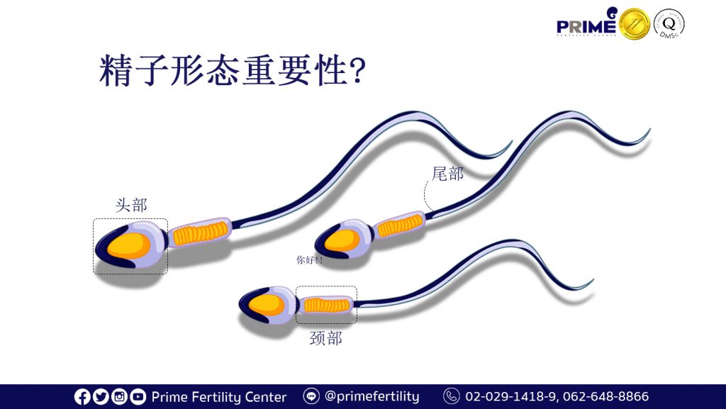 How is sperm morphology important,รูปร่างอสุจิสำคัญยังไง,精子形态重要性