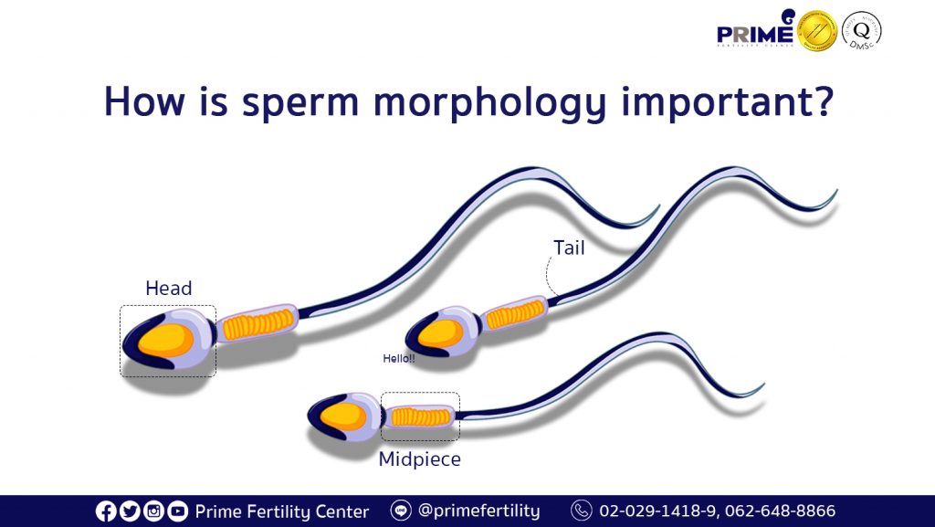 How is sperm morphology important,รูปร่างอสุจิสำคัญยังไง,精子形态重要性