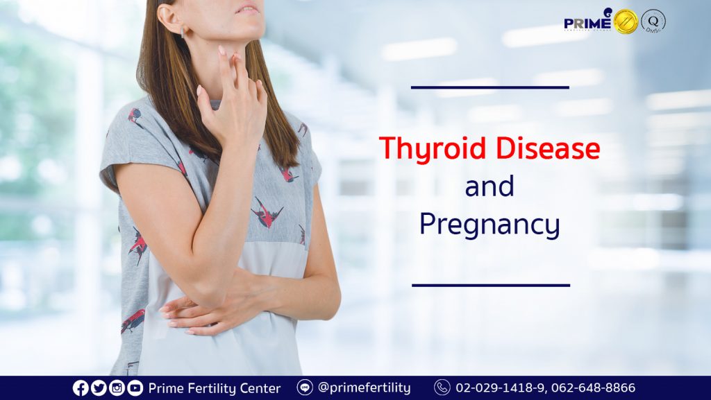 Thyroid Disease and Pregnancy,ไทรอยด์กับการท้อง,甲状腺与受孕