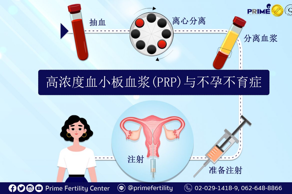 PRP Treatment and Infertility,PRP กับเรื่องมีบุตรยาก,高浓度血小板血浆 (PRP) 与不孕不育症