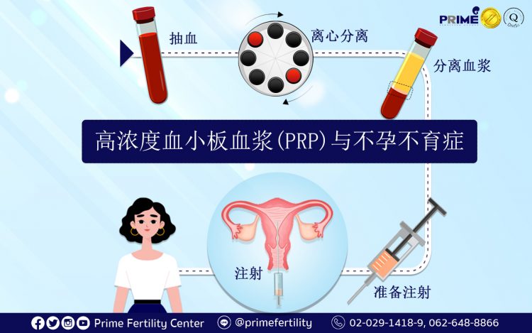 PRP Treatment and Infertility,PRP กับเรื่องมีบุตรยาก,高浓度血小板血浆 (PRP) 与不孕不育症