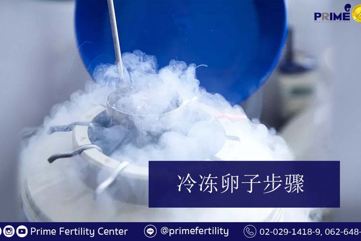 การฝากไข่แช่แข็ง, Egg Freezing,冷冻卵子