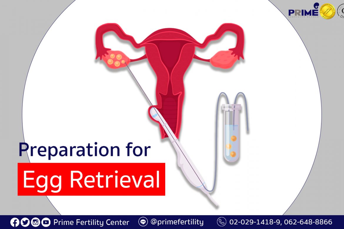 Preparation for Egg Retrieval, การเตรียมตัวก่อนการเก็บไข่, 取卵之前的准备