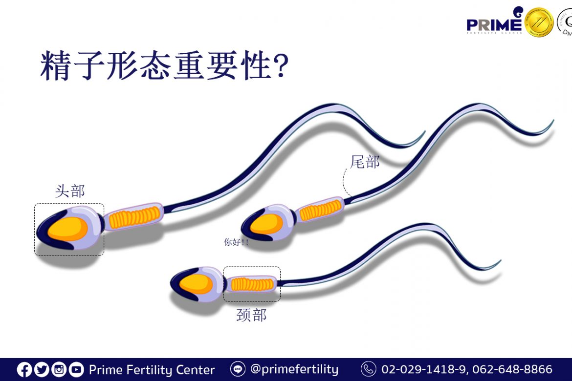 How is sperm morphology important,รูปร่างอสุจิสำคัญยังไง,精子形态重要性