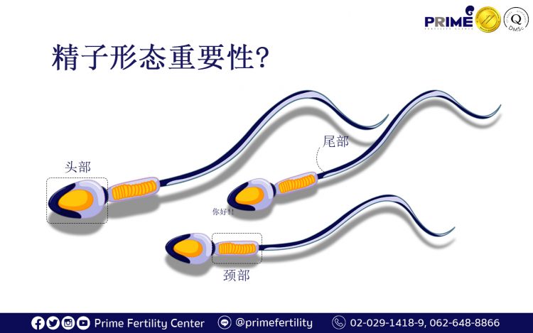 How is sperm morphology important,รูปร่างอสุจิสำคัญยังไง,精子形态重要性