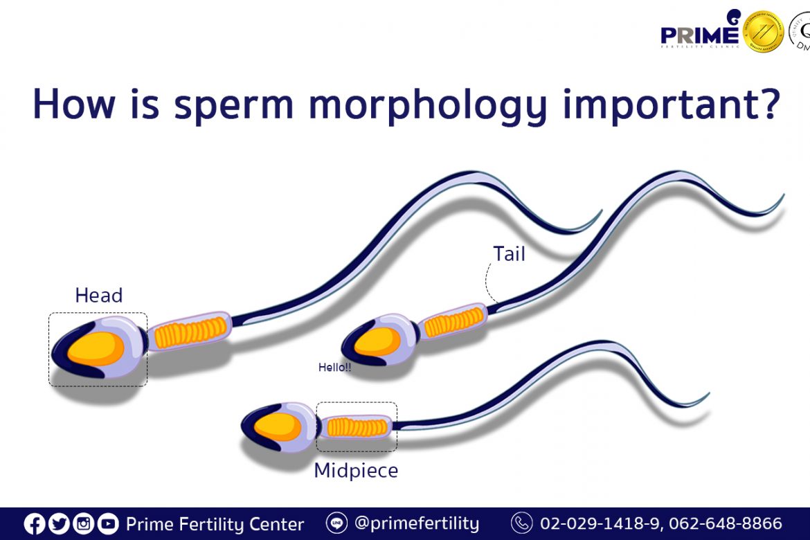 How is sperm morphology important,รูปร่างอสุจิสำคัญยังไง,精子形态重要性