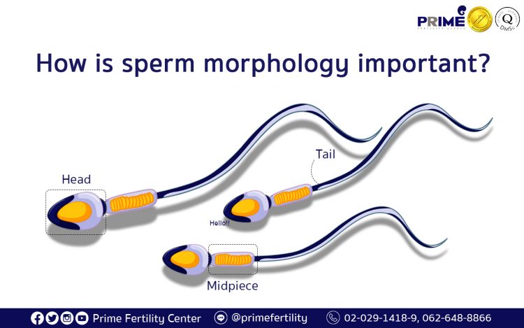 How is sperm morphology important,รูปร่างอสุจิสำคัญยังไง,精子形态重要性