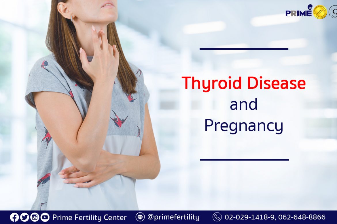 Thyroid Disease and Pregnancy,ไทรอยด์กับการท้อง,甲状腺与受孕