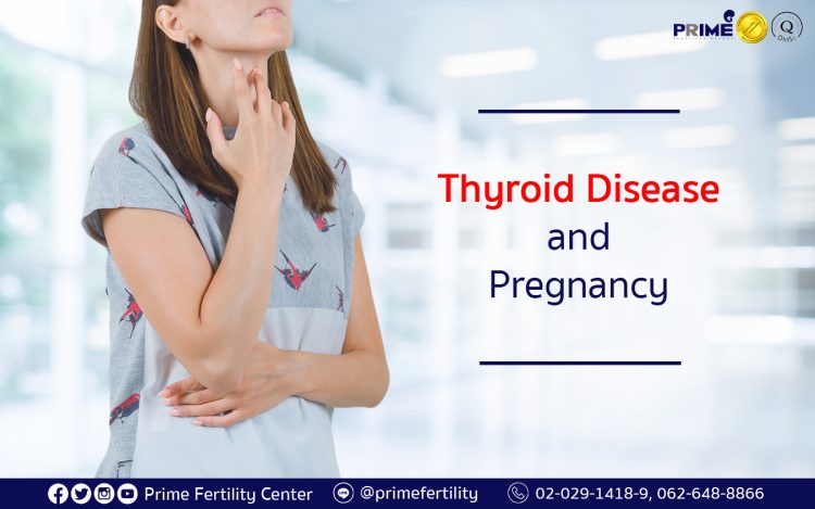 Thyroid Disease and Pregnancy,ไทรอยด์กับการท้อง,甲状腺与受孕