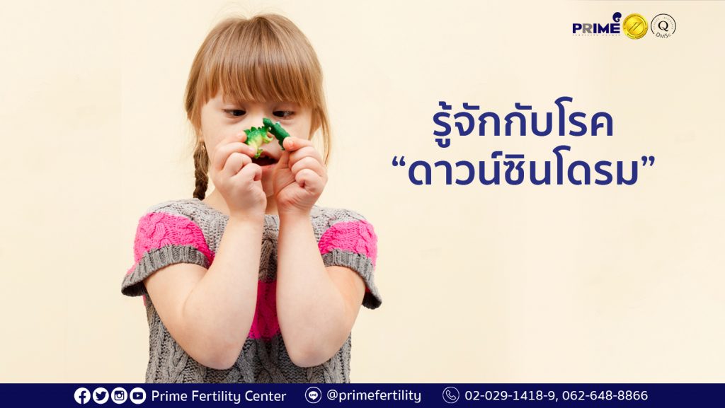 ดาวน์ซินโดรม