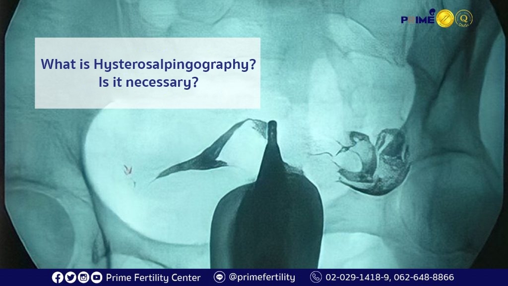 What is Hysterosalpingography? Is it necessary?