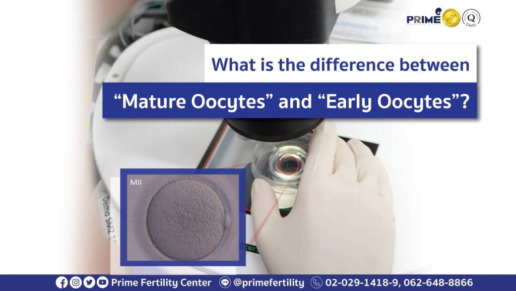 What is the difference between “Mature Oocytes” and “Early Oocytes”? - ไข่โตเต็มไวกับไข่อ่อน en ไข่โตเต็มไวกับไข่อ่อน en