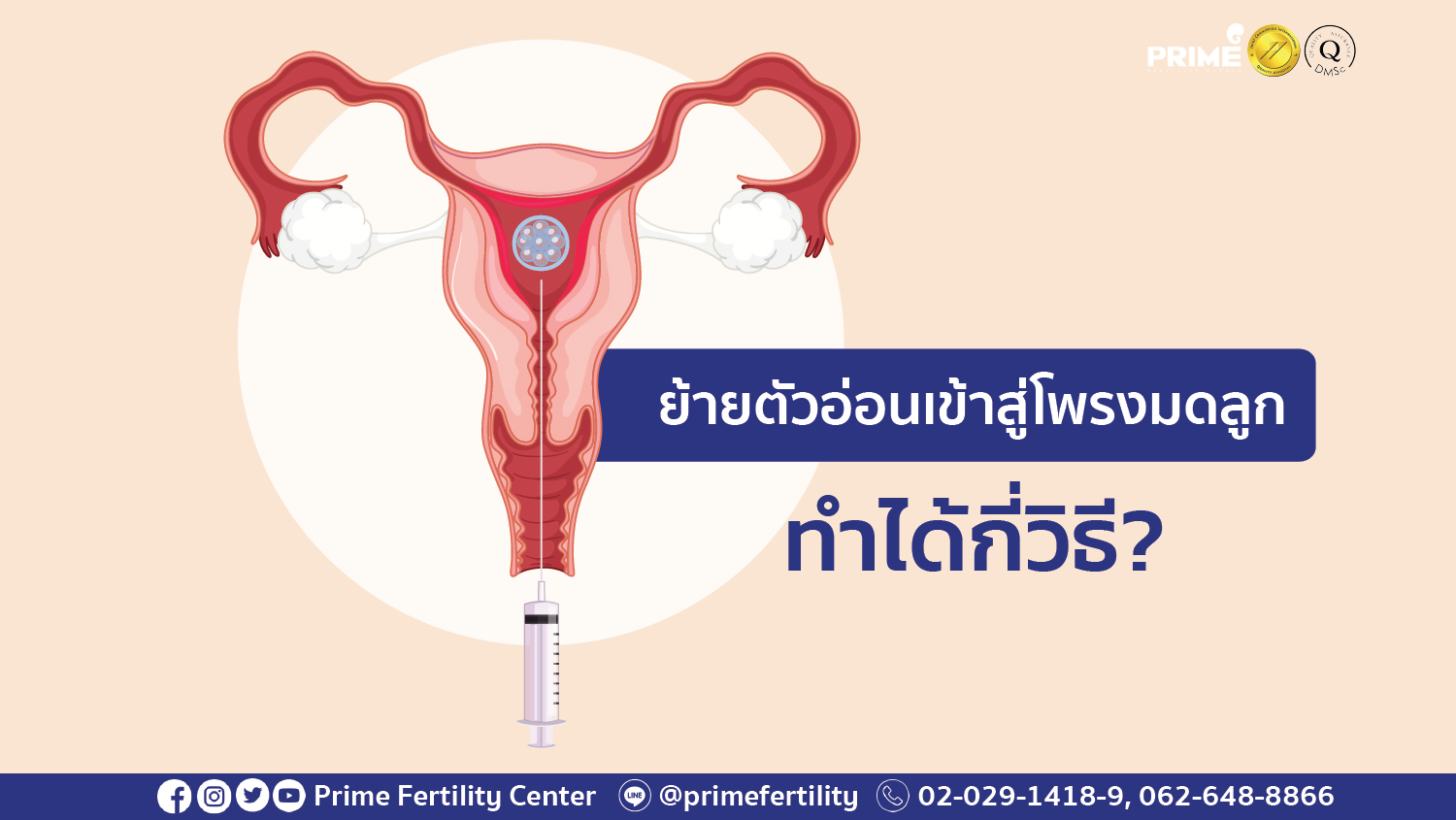 ย้ายตัวอ่อนได้กี่วิธี web