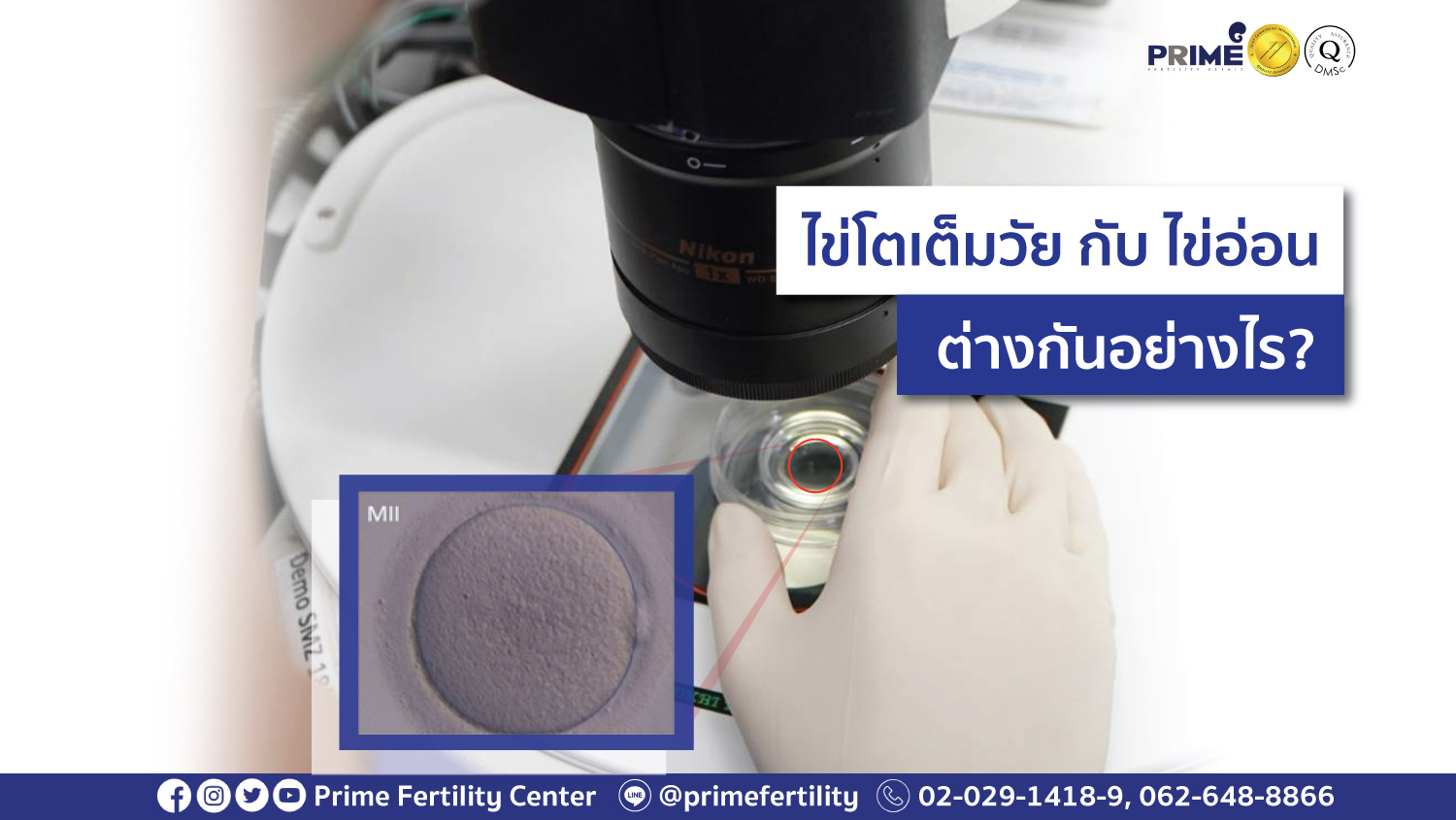 ไข่โตเต็มไวกับไข่อ่อน web