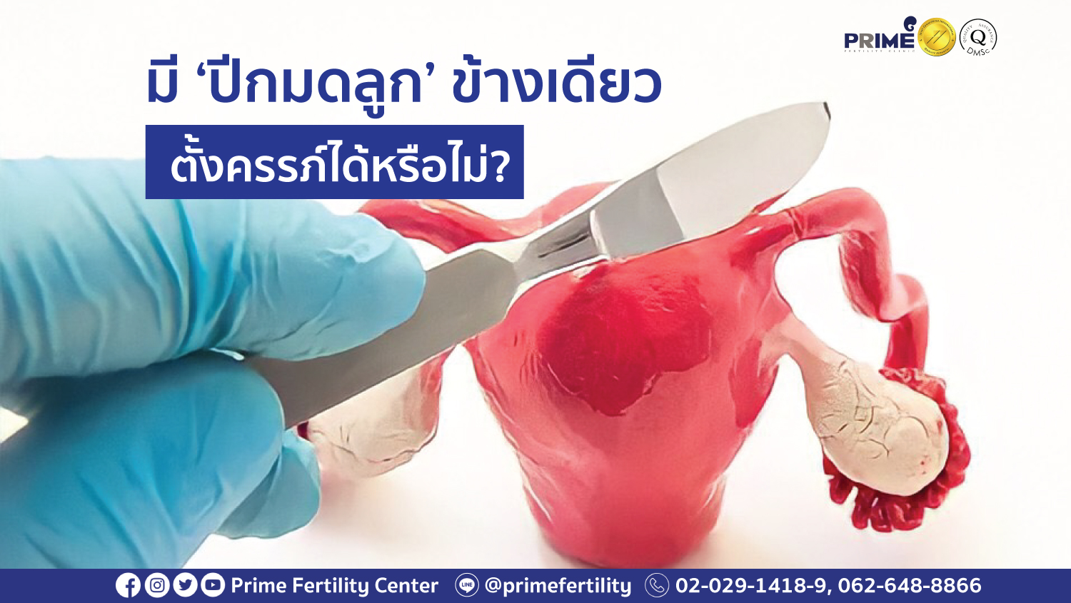 ปีกมกลูกข้างเดียว web